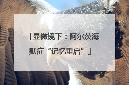 显微镜下：阿尔茨海默症“记忆重启”